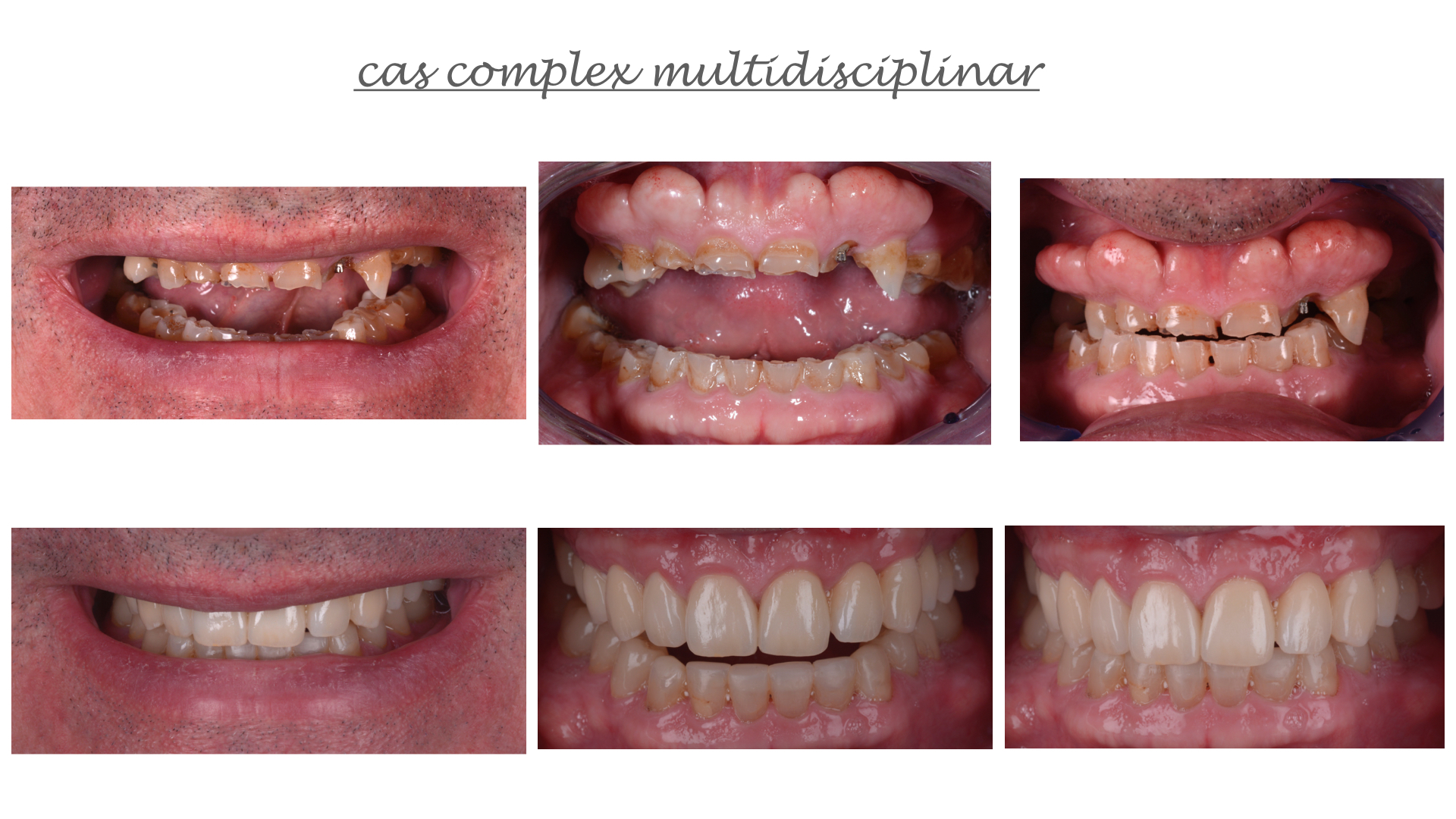 Cas complex multidisciplinar