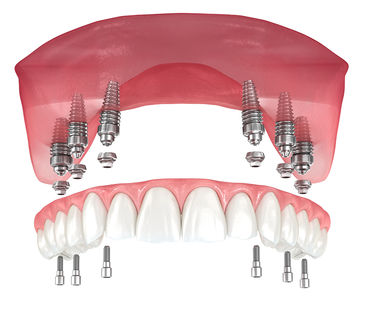 Pròtesis dentals mites i veritats