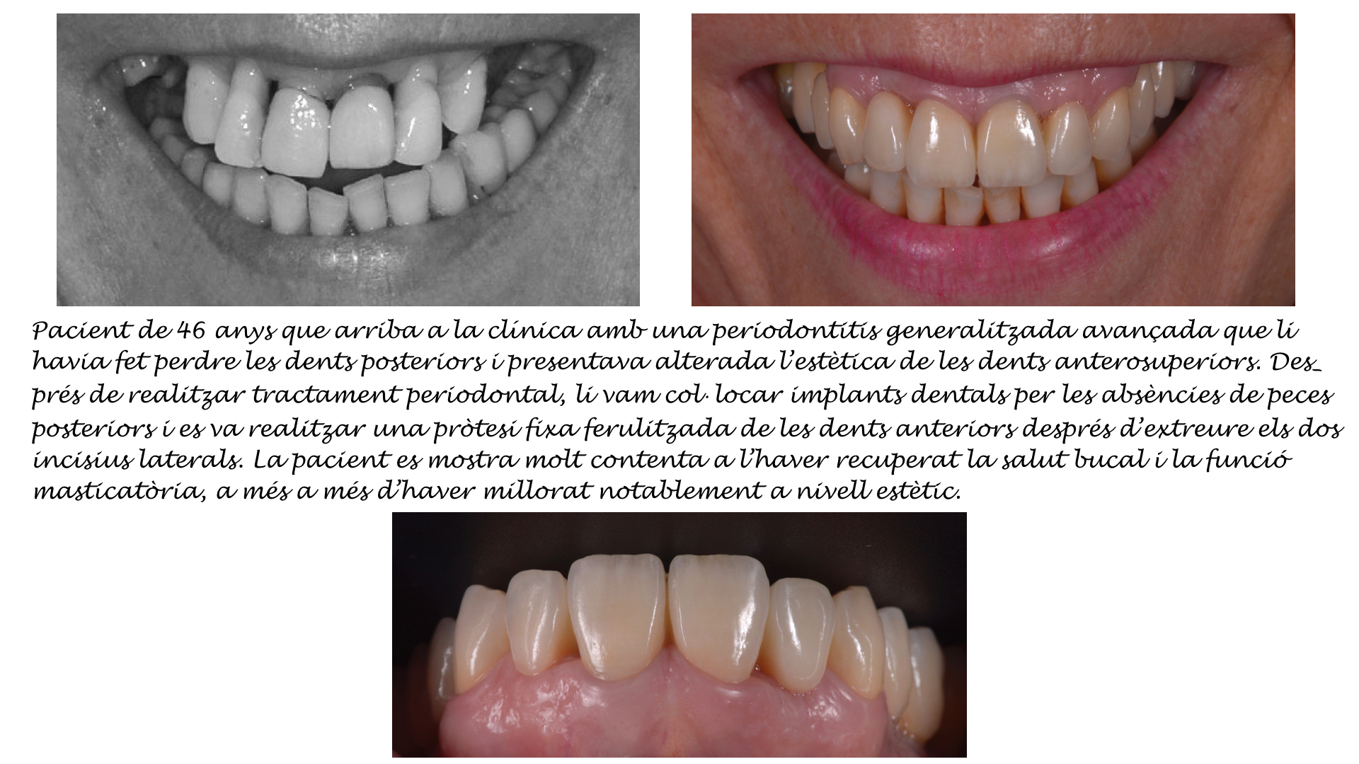 Tractament multidisciplinar: recuperació salut bucal