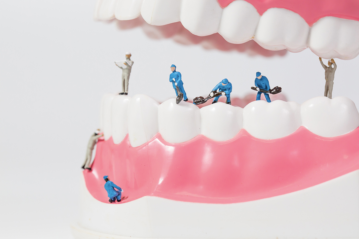 Les higienes dentals serveixen per tractar la periodontitis