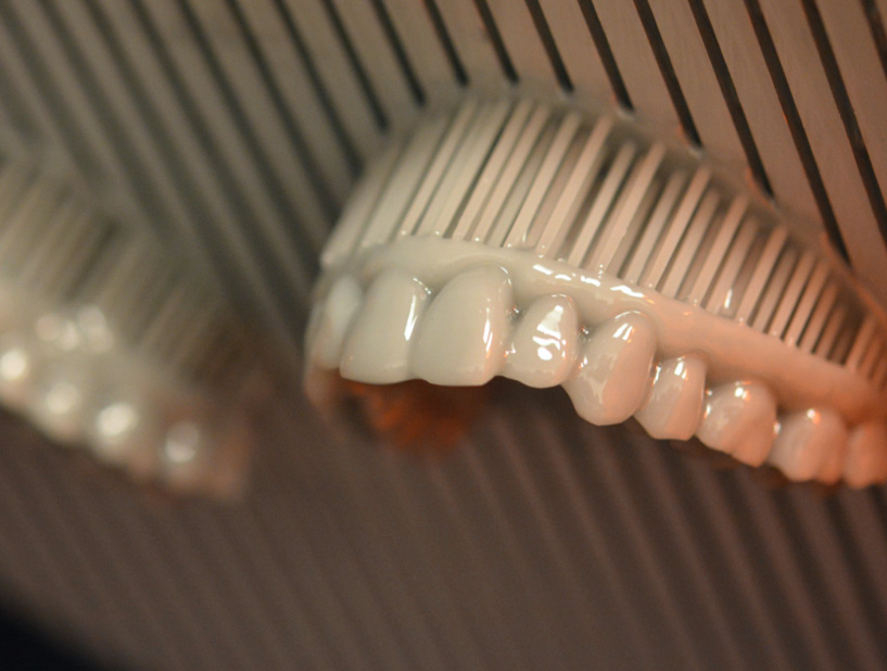 La impressió 3D s incorpora a les noves tecnologies digitals de Clínica Cervera