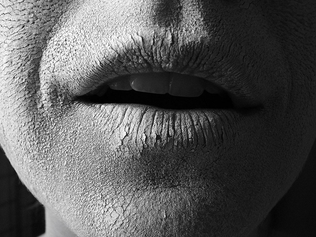 Xerostomia que fer davant la sindrome de la boca seca