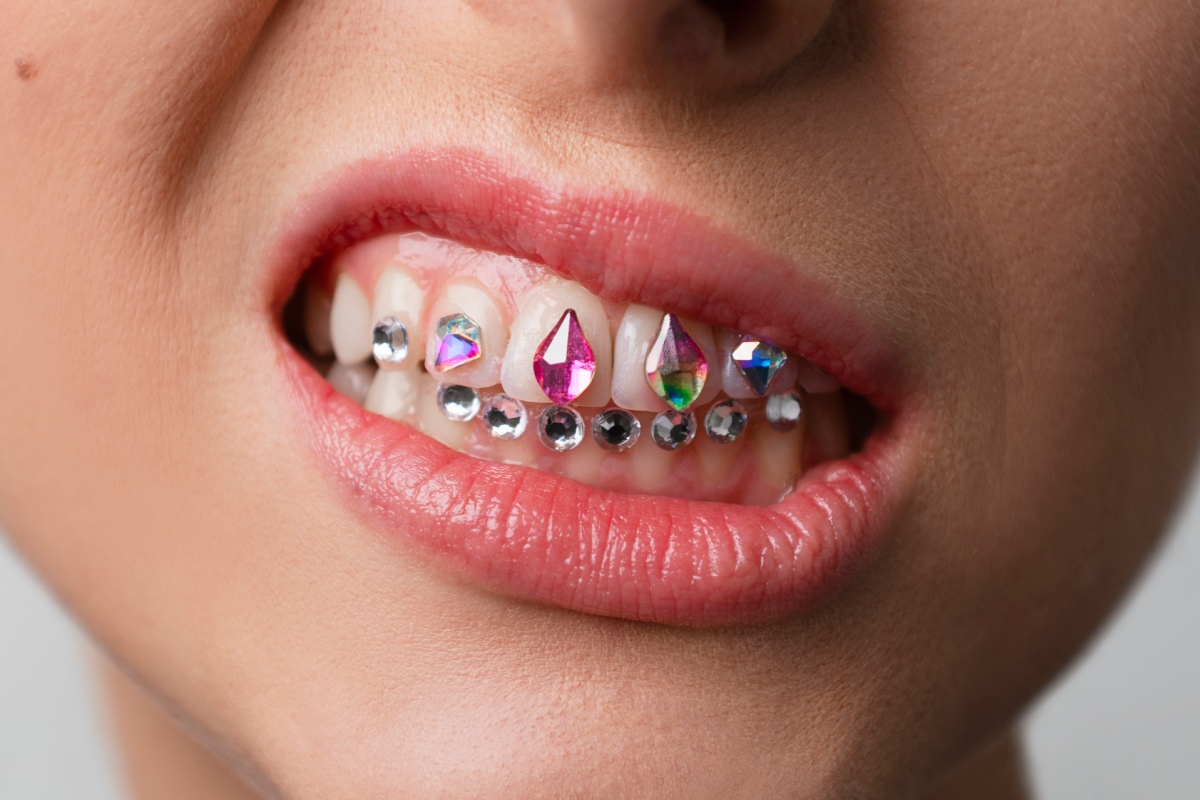 Compte amb el postureig dental