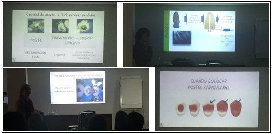Curs d’endodoncia