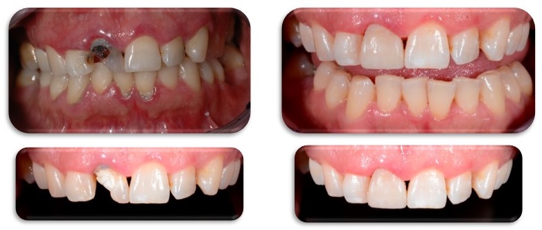 Tractament periodontal, conservador i d'estètica