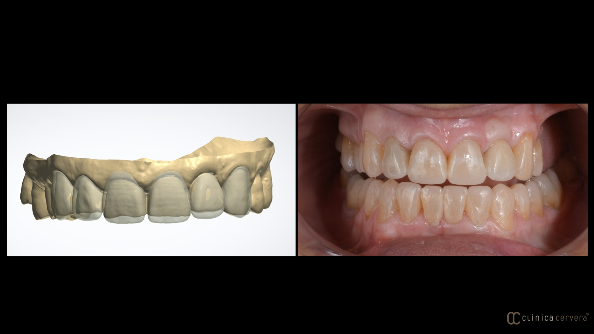 Rehabilitació oral