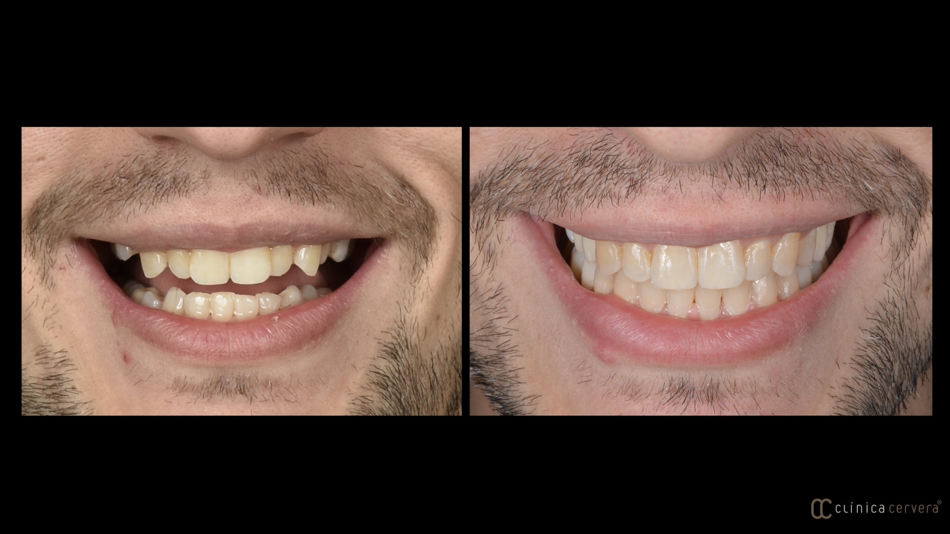Reconformació d'estructures òssies i dentals
